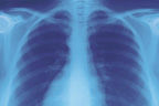 chest x-ray